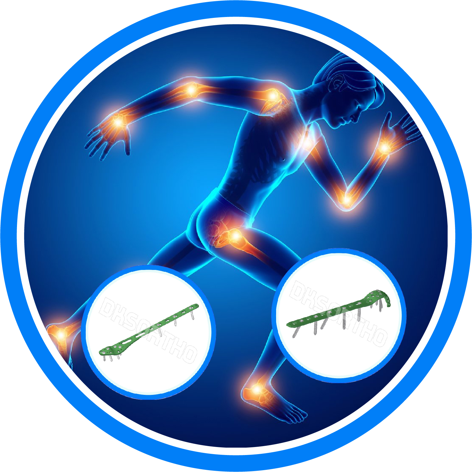 SHOULDER PROSTHESIS SYSTEM Manufacturer