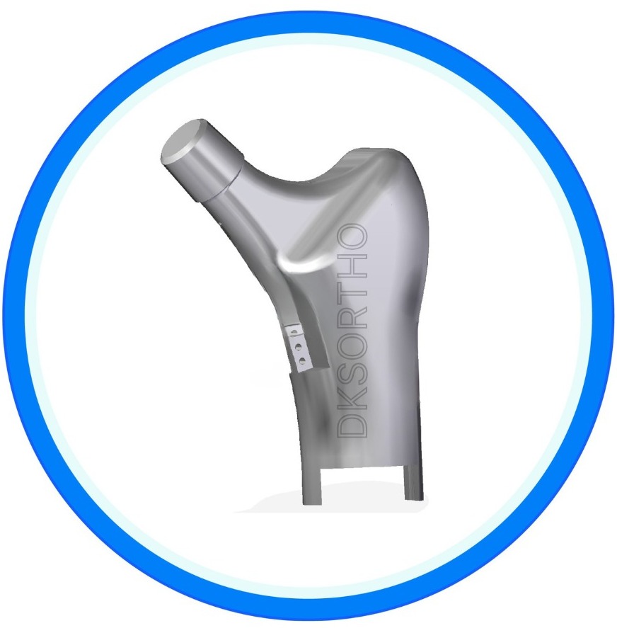 SHOULDER PROSTHESIS SYSTEM Manufacturer
